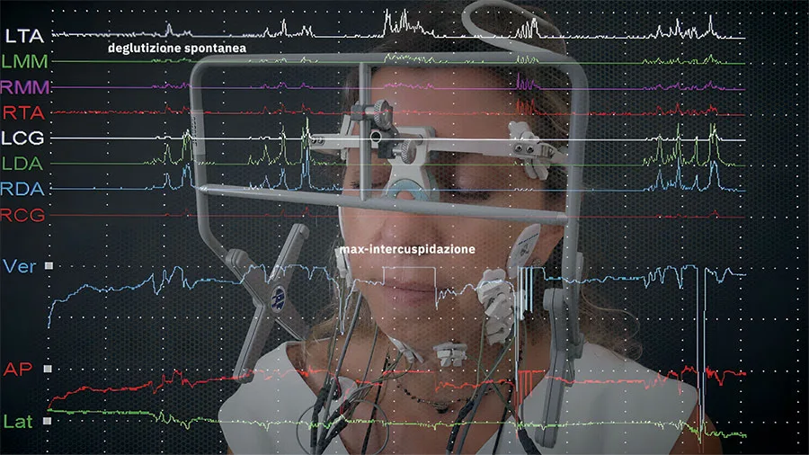 La ulf-tens ad ultra bassa frequenza per diagnosi e terapia odontoiatrica/ortodontica