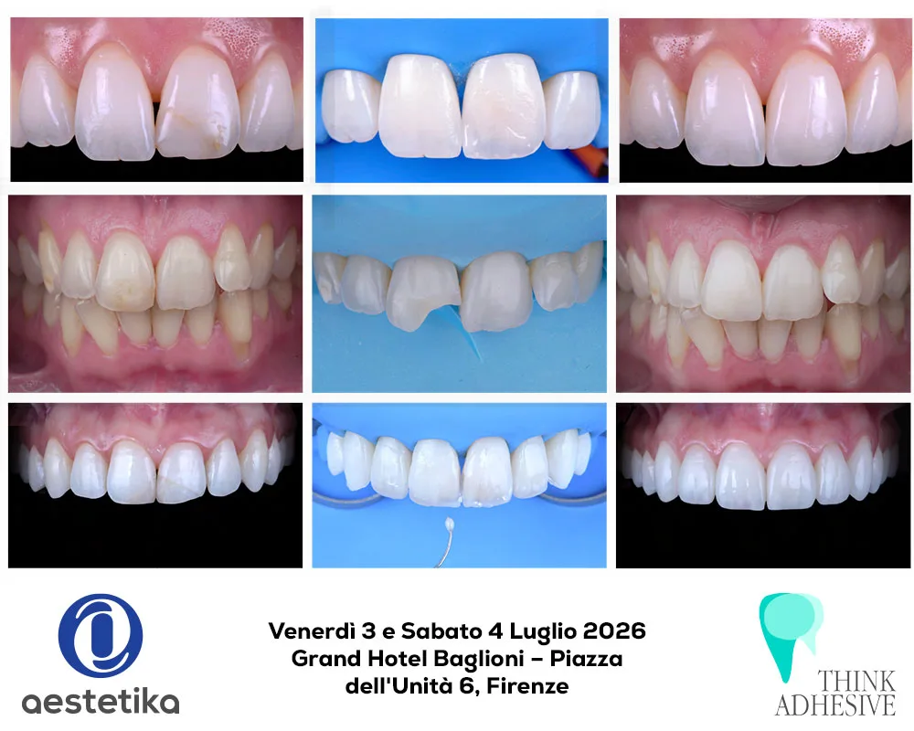 Corso Restauro anteriore Think Adhesive e Aestetika