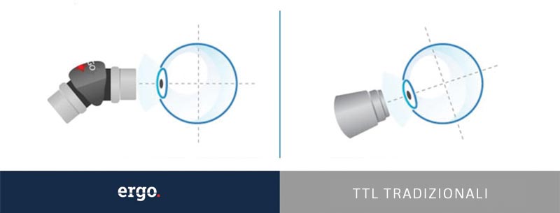 ergo vs tradizionali