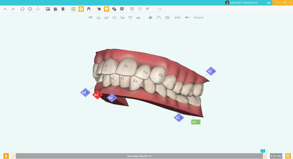 screen del software smile-engineering