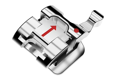 attacco-self-ligating-queen