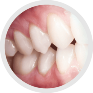 Nuovi occhiali ingrandenti prismatici 7.2X Admetec